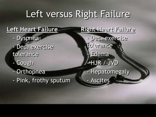 Left versus Right Failure
Left Heart Failure        Right Heart Failure
  - Dyspnea                 - Dec. exercise
  - Dec. exercise           tolerance
  tolerance                 - Edema
  - Cough                   - HJR / JVD
  - Orthopnea               - Hepatomegaly
  - Pink, frothy sputum     - Ascites
 