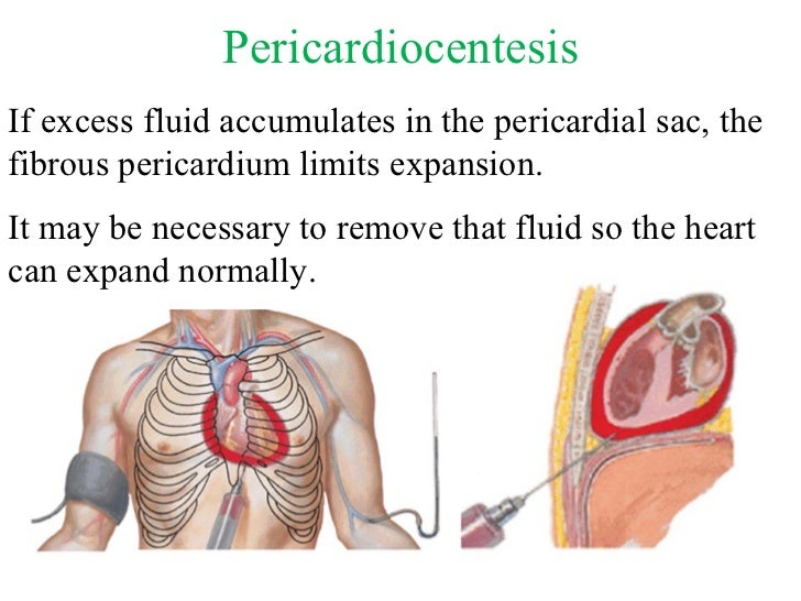 fluid retention congestive heart failure