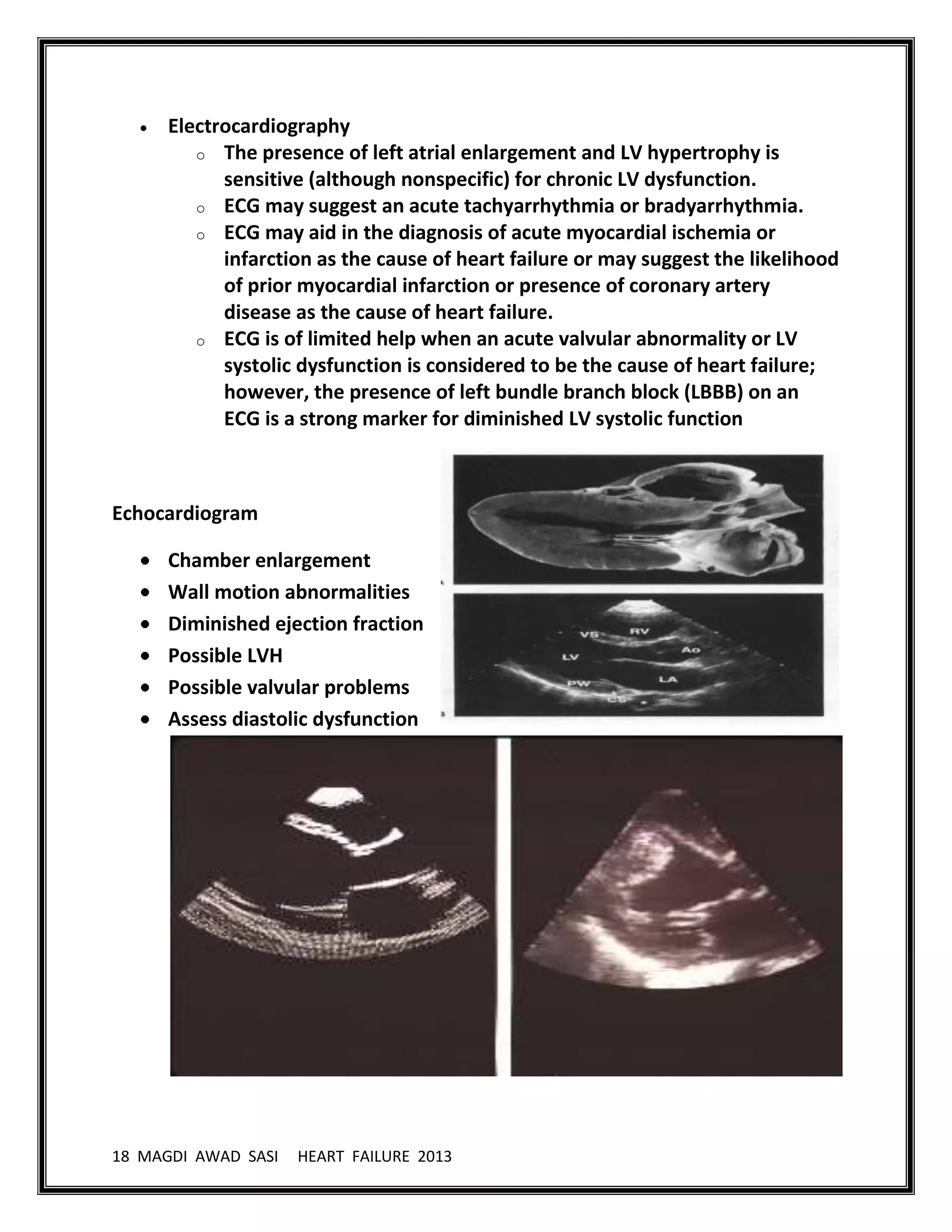 18 MAGDI AWAD SASI HEART FAILURE 2013
Electrocardiography
o The presence of left atrial enlargement and LV hypertrophy is
sensitive (although nonspecific) for chronic LV dysfunction.
o ECG may suggest an acute tachyarrhythmia or bradyarrhythmia.
o ECG may aid in the diagnosis of acute myocardial ischemia or
infarction as the cause of heart failure or may suggest the likelihood
of prior myocardial infarction or presence of coronary artery
disease as the cause of heart failure.
o ECG is of limited help when an acute valvular abnormality or LV
systolic dysfunction is considered to be the cause of heart failure;
however, the presence of left bundle branch block (LBBB) on an
ECG is a strong marker for diminished LV systolic function
Echocardiogram
Chamber enlargement
Wall motion abnormalities
Diminished ejection fraction
Possible LVH
Possible valvular problems
Assess diastolic dysfunction
 