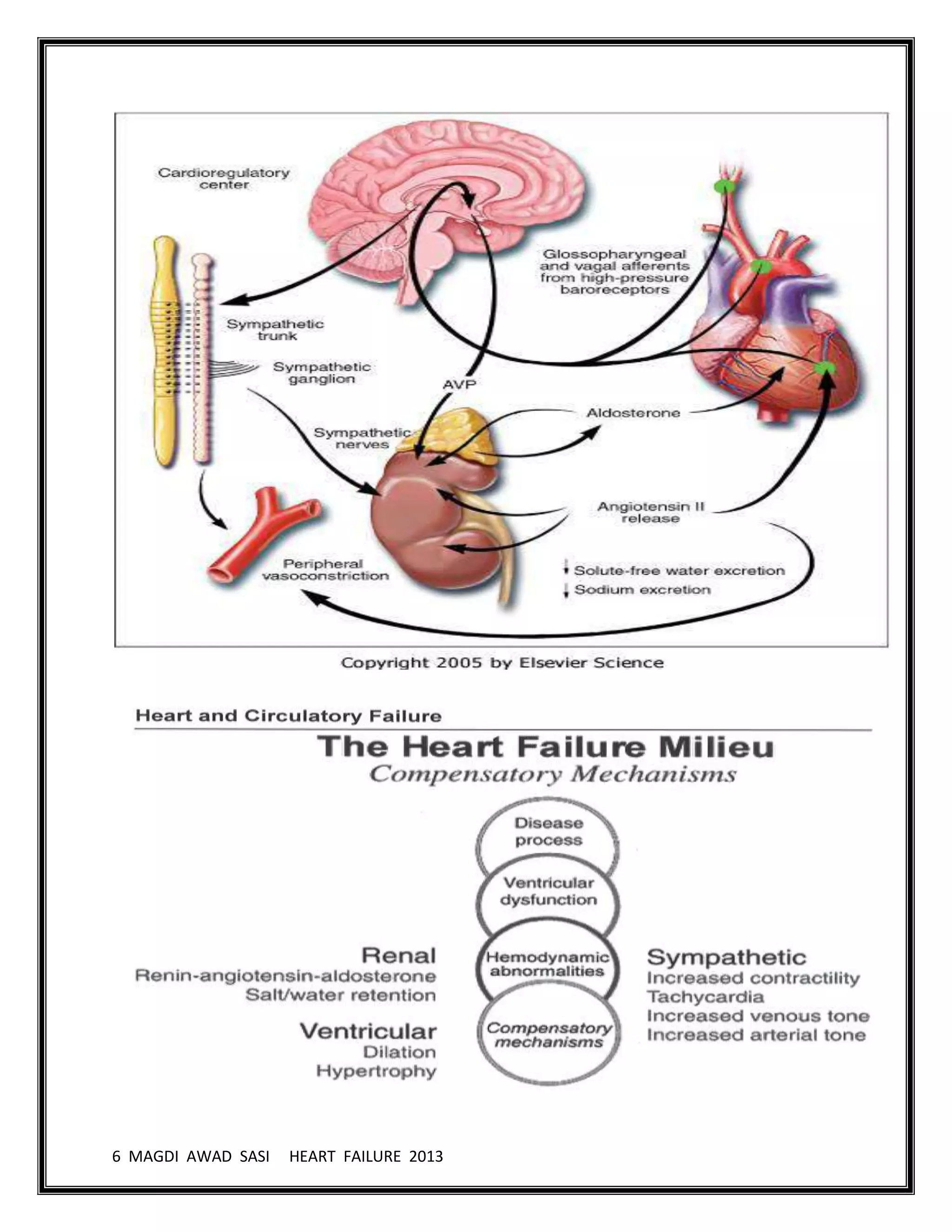 6 MAGDI AWAD SASI HEART FAILURE 2013
 