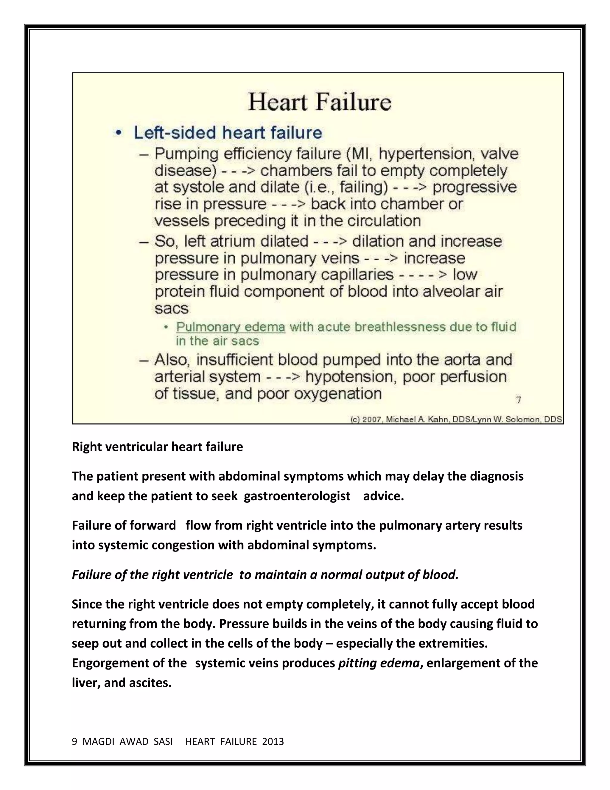 9 MAGDI AWAD SASI HEART FAILURE 2013
Right ventricular heart failure
The patient present with abdominal symptoms which may delay the diagnosis
and keep the patient to seek gastroenterologist advice.
Failure of forward flow from right ventricle into the pulmonary artery results
into systemic congestion with abdominal symptoms.
Failure of the right ventricle to maintain a normal output of blood.
Since the right ventricle does not empty completely, it cannot fully accept blood
returning from the body. Pressure builds in the veins of the body causing fluid to
seep out and collect in the cells of the body – especially the extremities.
Engorgement of the systemic veins produces pitting edema, enlargement of the
liver, and ascites.
 