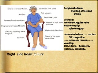 Right	
  	
  side	
  heart	
  failure	

Peripheral	
  edema:	
  
	
  	
  	
  	
  Swelling	
  of	
  feet	
  and	
  	
  	
  
	
  ankles:	
  	
  
	
  	
  	
  	
  	
  	
  
Cyanosis:	
  	
  	
  
Prominent	
  jugular	
  veins	
  	
  	
  
Hepatomegaly:	
  	
  	
  
	
  splenomegaly.	
  
	
  
	
  abdominal	
  edema	
  …..	
  	
  ascites.	
  
	
  GIT	
  congestion	
  
…….anorexia,	
  nausea,	
  	
  ……
vomiting.	
  
CNS.	
  Edema	
  	
  -­‐	
  	
  headache,	
  	
  	
  
insomnia,	
  irritability.	
	
  
	
  

 