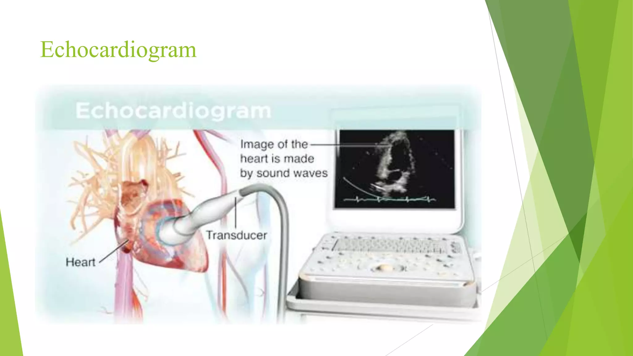 Congestive heart failure | PPTX