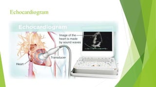 Echocardiogram
 