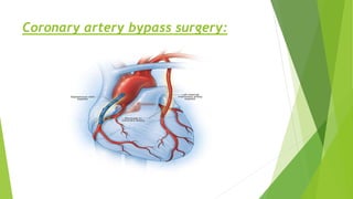 Coronary artery bypass surgery:
 