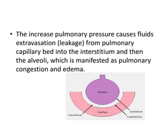 • The increase pulmonary pressure causes fluids
extravasation (leakage) from pulmonary
capillary bed into the interstitium and then
the alveoli, which is manifested as pulmonary
congestion and edema.
 