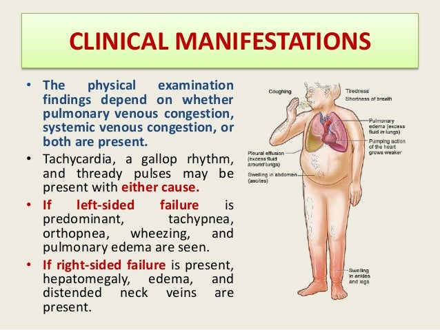 Clinical signs of left sided heart failure