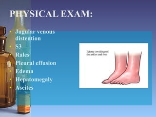 PHYSICAL EXAM: Jugular venous distention S3 Rales Pleural effusion Edema Hepatomegaly Ascites 