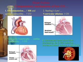 Heart Failure  Compensatory mechanisms of low CO… 1.  SNS stimulation…  ↑  HR  and  cardiac contractility…  ↑  CO 3. Ventricular hypertrophy … cardiac contractility… ↑ CO 2. Starling’s Law/… Ventricular dilation :  ↑  CO  4 . Decreased renal blood flow…increasing Na & H20 retention…increases blood volume, ↑ HR & CO. 