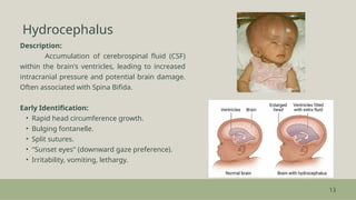 Early Intervention Strategies for Congenital Neurological Disorders in ...