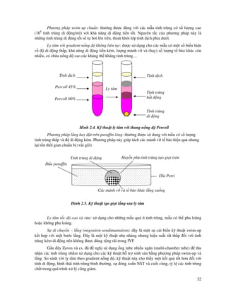 32
Phương pháp swim up chu n: thư ng ư c dùng v i các m u tinh trùng có s lư ng cao
(106
tinh trùng di ng/ml) v i kh năng di ng ti n t t. Nguyên t c c a phương pháp này là
nh ng tinh trùng di ng t t s t bơi lên trên, thoát kh i l p tinh d ch phía dư i.
Ly tâm v i gradient n ng không liên t c: ư c s d ng cho các m u có m t s bi u hi n
v di ng th p, kh năng di ng ti n kém, lư ng m nh v và (hay) s lư ng t bào khác còn
nhi u, có ch a n ng cao các kháng th kháng tinh trùng…
Hình 2.4. K thu t ly tâm v i thang n ng Percoll
Phương pháp l ng hay t trên paraffin l ng: thư ng ư c s d ng v i m u có s lư ng
tinh trùng th p và di ng kém. Phương pháp này giúp tách các m nh v t bào hi u qu nhưng
l i t n th i gian chu n b (vài gi ).
Hình 2.5. K thu t t o gi t l ng sau ly tâm
Ly tâm t c cao và r a: s d ng cho nh ng m u quá ít tinh trùng, m u có th pha loãng
ho c không pha loãng.
S di chuy n – l ng (migration-sendimantation): ây là m t s c i bi n k thu t swim-up
k t h p v i m t bư c l ng. ây là m t k thu t nh nhàng nhưng hi u su t r t th p i v i tinh
trùng kém di ng nên không ư c dùng r ng rãi trong IVF
G n ây Zavos và cs. ã ngh s d ng ng tube nhi u ngăn (multi-chamber tube) thu
nh n các tinh trùng nh m s d ng cho các k thu t h tr sinh s n b ng phương pháp swim-up và
l ng. So sánh v i ly tâm theo gradient n ng , k thu t này cho th y m t k t qu t t hơn i v i
tính di ng, hình thái tinh trùng bình thư ng, s óng xo n NST và cu i cùng, t l các tinh trùng
ch t trong quá trình x lý cũng gi m.
Percoll 90%
Percoll 45%
Tinh d ch
Ly tâm
Tinh trùng
di ng
Tinh trùng
b t ng
Tinh d ch
ĩa Petri
D u paraffin
Huy n phù tinh trùng t o gi t tròn
Các m nh v và t bào khác l ng xu ng
Tinh trùng di ng
 