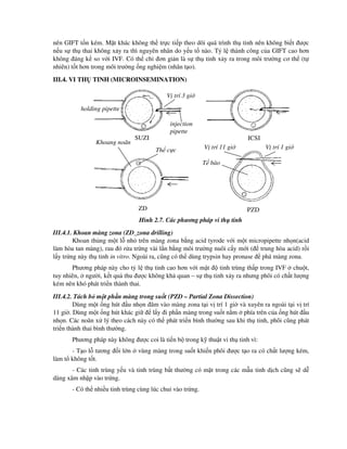 nên GIFT t n kém. M t khác không th tr c ti p theo dõi quá trình th tinh nên không bi t ư c
n u s th thai không x y ra thì nguyên nhân do y u t nào. T l thành công c a GIFT cao hơn
không áng k so v i IVF. Có th ch ơn gi n là s th tinh x y ra trong môi trư ng cơ th (t
nhiên) t t hơn trong môi trư ng ng nghi m (nhân t o).
III.4. VI TH TINH (MICROINSEMINATION)
Hình 2.7. Các phương pháp vi th tinh
III.4.1. Khoan màng zona (ZD_zona drilling)
Khoan th ng m t l nh trên màng zona b ng acid tyrode v i m t micropipette nh n(acid
làm hòa tan màng), rau ó r a tr ng vài l n b ng môi trư ng nuôi c y m i ( trung hòa acid) r i
l y tr ng này th tinh in vitro. Ngoài ra, cũng có th dùng trypsin hay pronase phá màng zona.
Phương pháp này cho t l th tinh cao hơn v i m t tinh trùng th p trong IVF chu t,
tuy nhiên, ngư i, k t qu thu ư c không kh quan – s th tinh x y ra nhưng phôi có ch t lư ng
kém nên khó phát tri n thành thai.
III.4.2. Tách b m t ph n màng trong su t (PZD – Partial Zona Dissection)
Dùng m t ng hút u nh n âm vào màng zona t i v trí 1 gi và xuyên ra ngoài t i v trí
11 gi . Dùng m t ng hút khác gi l y i ph n màng trong su t n m phía trên c a ng hút u
nh n. Các noãn x lý theo cách này có th phát tri n bình thư ng sau khi th tinh, phôi cũng phát
tri n thành thai bình thư ng.
Phương pháp này không ư c coi là ti n b trong k thu t vi th tinh vì:
- T o l tương i l n vùng màng trong su t khi n phôi ư c t o ra có ch t lư ng kém,
làm t không t t.
- Các tinh trùng y u và tinh trùng b t thư ng có m t trong các m u tinh d ch cũng s d
dàng xâm nh p vào tr ng.
- Có th nhi u tinh trùng cùng lúc chui vào tr ng.
SUZI ICSI
ZD PZD
V trí 11 gi V trí 1 gi
holding pipette
injection
pipette
Khoang noãn
Th c c
T bào
V trí 3 gi
 