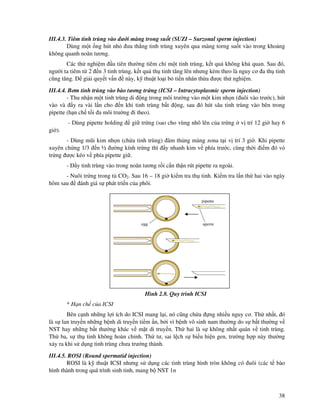 38
III.4.3. Tiêm tinh trùng vào dư i màng trong su t (SUZI – Surzonal sperm injection)
Dùng m t ng hút nh ưa th ng tinh trùng xuyên qua màng torng su t vào trong kho ng
không quanh noãn tương.
Các th nghi m u tiên thư ng tiêm ch m t tinh trùng, k t qu không kh quan. Sau ó,
ngư i ta tiêm t 2 n 3 tinh trùng, k t qu th tinh tăng lên nhưng kèm theo là nguy cơ a th tinh
cũng tăng. gi i quy t v n này, k thu t lo i b ti n nhân th a ư c th nghi m.
III.4.4. Bơm tinh trùng vào bào tương tr ng (ICSI – Intracytoplasmic sperm injection)
- Thu nh n m t tinh trùng di ng trong môi trư ng vào m t kim nh n ( uôi vào trư c), hút
vào và y ra vài l n cho n khi tinh trùng b t ng, sau ó hút sâu tinh trùng vào bên trong
pipette (h n ch t i a môi trư ng i theo).
- Dùng pipette holding gi tr ng (sao cho vùng nhô lên c a tr ng v trí 12 gi hay 6
gi ).
- Dùng mũi kim nh n (ch a tinh trùng) âm th ng màng zona t i v trí 3 gi . Khi pipette
xuyên ch ng 1/3 n ½ ư ng kính tr ng thì y nhanh kim v phía trư c, cùng th i i m ó v
tr ng ư c kéo v phía pipette gi .
- y tinh trùng vào trong noãn tương r i c n th n rút pipette ra ngoài.
- Nuôi tr ng trong t CO2. Sau 16 – 18 gi ki m tra th tinh. Ki m tra l n th hai vào ngày
hôm sau ánh giá s phát tri n c a phôi.
Hình 4.34. Quy trình ICSI
Hình 2.8. Quy trình ICSI
* H n ch c a ICSI
Bên c nh nh ng l i ích do ICSI mang l i, nó cũng ch a ng nhi u nguy cơ. Th nh t, ó
là s lan truy n nh ng b nh di truy n ti m n, b i vì b nh vô sinh nam thư ng do s b t thư ng v
NST hay nh ng b t thư ng khác v m t di truy n. Th hai là s không nh t quán v tinh trùng.
Th ba, s th tinh không hoàn ch nh. Th tư, sai l ch s bi u hi n gen, trư ng h p này thư ng
x y ra khi s d ng tinh trùng chưa trư ng thành.
III.4.5. ROSI (Round spermatid injection)
ROSI là k thu t ICSI nhưng s d ng các tinh trùng hình tròn không có uôi (các t bào
hình thành trong quá trình sinh tinh, mang b NST 1n
 
