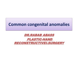 DR.RABAB ABASS
PLASTIC-HAND
SURGERY
&
RECONSTRUCTIVE
Common congenital anomalies
 