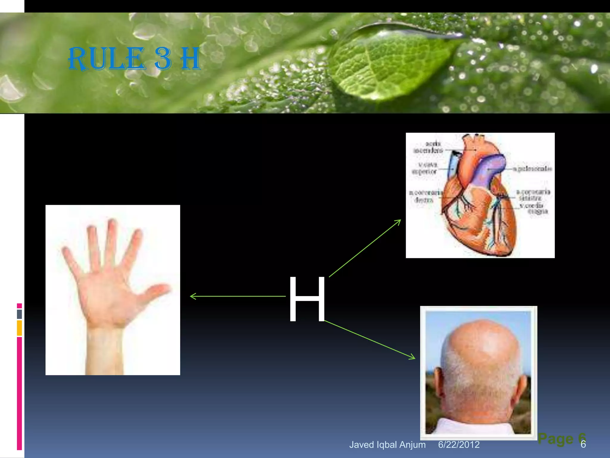 Rule 3 H   Powerpoint Template




                    H
                            Javed Iqbal Anjum   6/22/2012   Page 6
                                                                 6
 