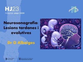 Neurosonografia:
Lesions tardanes i
    evolutives

 Dr G Albaiges
 