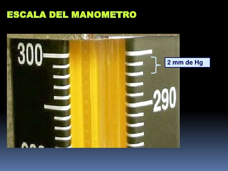 Cinco cuestiones sobre fisiopatologia de la hipertensión arterial