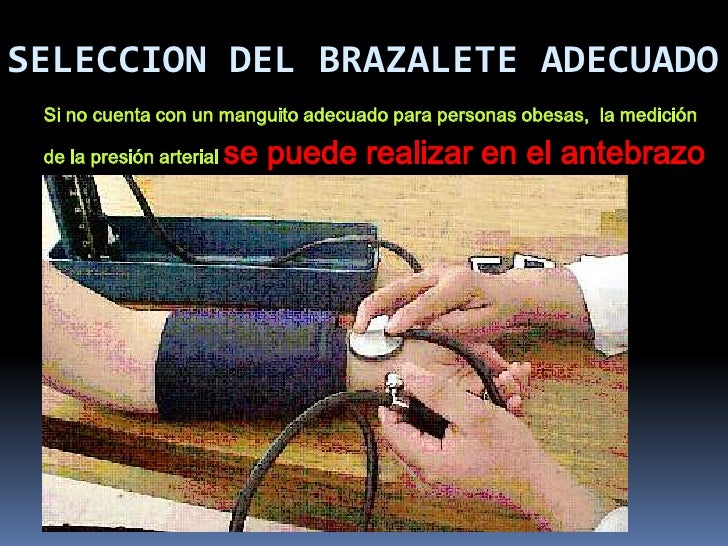 Las ideas acerca de hipertensión del corazon