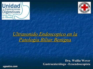 Ultrasonido Endoscopico en la Patología Biliar Benigna Dra. Wallia Wever Gastroenterólogo –Ecoendoscopista ugastro.com 