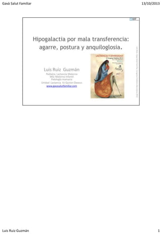 Lactancia materna: Hipogalactia por mala trasferencia: Síndrome de posicion inadecuada. Fedalma 2013. Luis Ruiz Guzmán