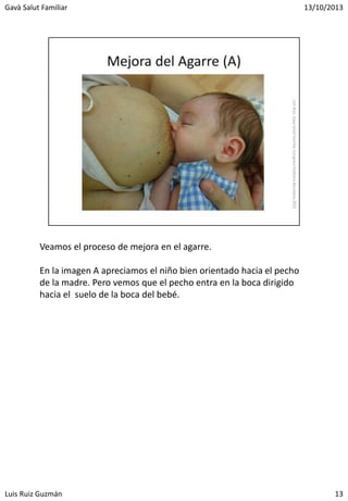 Lactancia materna: Hipogalactia por mala trasferencia: Síndrome de posicion inadecuada. Fedalma 2013. Luis Ruiz Guzmán