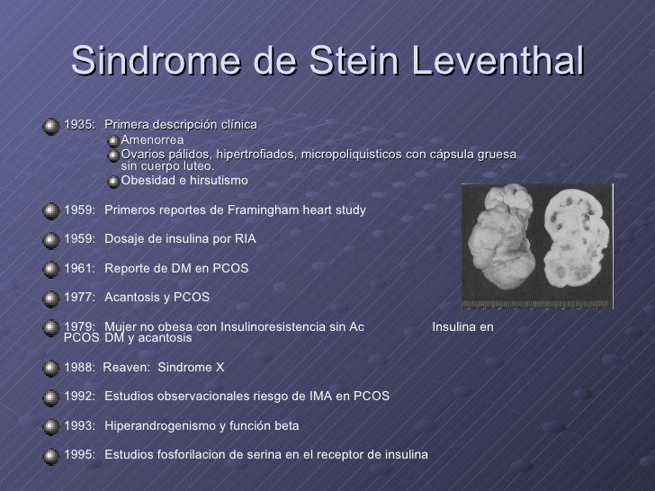 A Sindrome De Stein Leventhal Tambem Conhecida Como