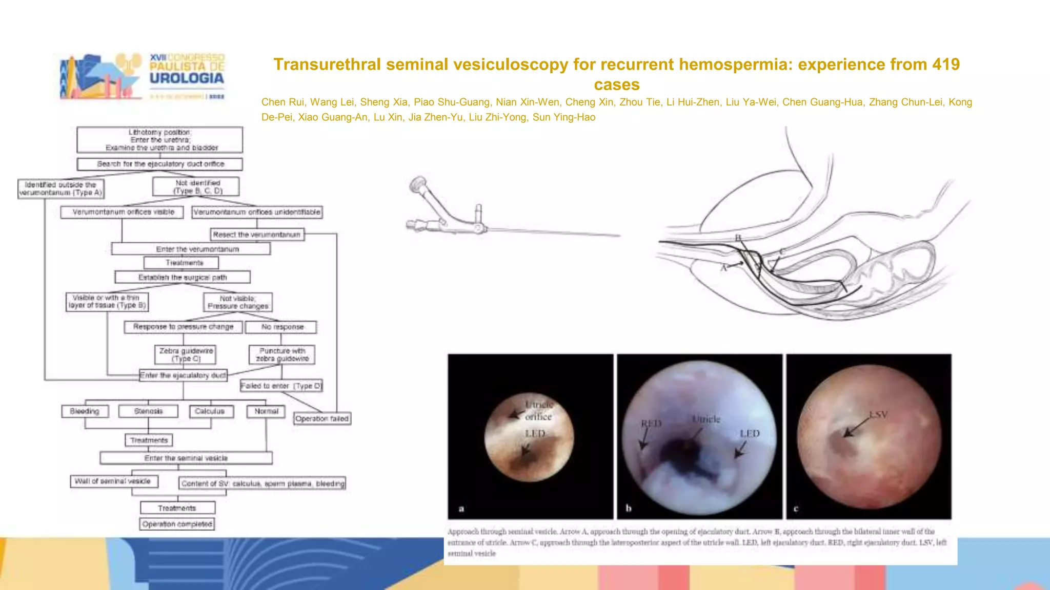 Transurethral seminal vesiculoscopy for chronic pelvic pain syndrome ...