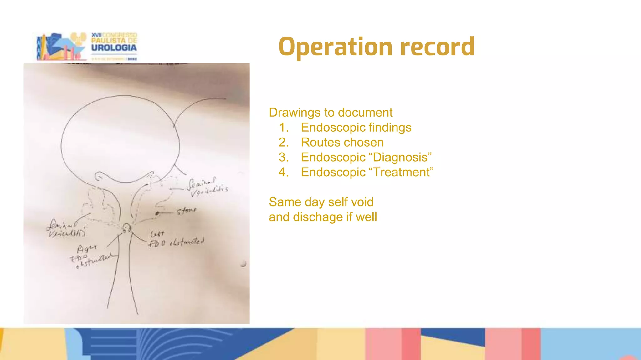 Transurethral seminal vesiculoscopy for chronic pelvic pain syndrome ...