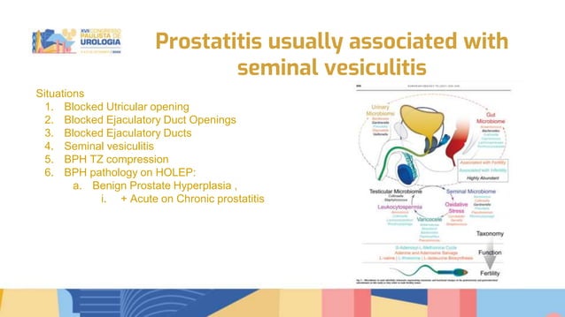 Transurethral seminal vesiculoscopy for chronic pelvic pain syndrome ...