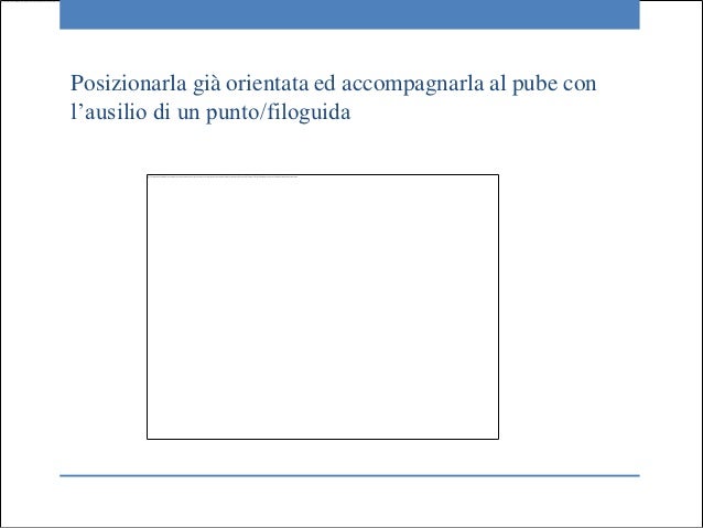 Dispositivo di eliminazione laser di lentiggini