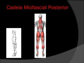 Cadeia Miofascial Posterior
 