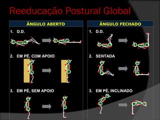 Reeducação Postural Global
ÂNGULO ABERTO ÂNGULO FECHADO
1. D.D.
2. EM PÉ, COM APOIO
3. EM PÉ, SEM APOIO
1. D.D.
2. SENTADA
3. EM PÉ, INCLINADO
 