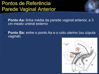Pontos de Referência Parede Vaginal   Anterior Ponto Aa:  linha média da parede vaginal anterior, a 3 cm meato uretral externo Ponto Ba:  entre o ponto Aa e o colo uterino (ou cúpula vaginal) 