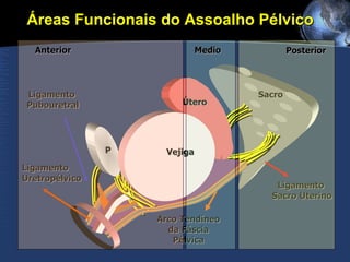 Ligamento  Sacro Uterino Arco Tendíneo da Fáscia Pélvica Vejiga Útero P Ligamento  Pubouretral Sacro Áreas Funcionais do Assoalho Pélvico Anterior Medio Posterior Ligamento  Uretropélvico 