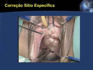 Correção Sítio Específica 