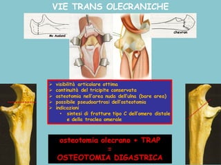 VIE TRANS OLECRANICHE
Ø visibilità articolare ottima
Ø continuità del tricipite conservata
Ø osteotomia nell’area nuda dell’ulna (bare area)
Ø possibile pseudoartrosi dell’osteotomia
Ø indicazioni
• sintesi di fratture tipo C dell’omero distale
e della troclea omerale
osteotomia olecrano + TRAP
=
OSTEOTOMIA DIGASTRICA
chevron
 