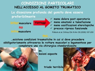 CONDIZIONI PARTICOLARI
NELL’ACCESSO AL GOMITO TRUMATICO
ü meno dolore post operatorio
ü meno ematomi e tumefazione
ü meno ossificazioni eterotopiche
ü precoce ripresa funzionale
Pollock et al. Orthop Clin N Am 39 (2008) 187-200
ma...
…esistono condizioni traumatiche in cui si deve procedere
obbligatoriamente attraverso le rotture muscolari e legamentose per
completare una via chirurgica standardizzata
intermuscolare
no
intramuscolare
es.
lesioni esposte
e
triade terribile
La dissezione profonda del gomito deve essere
preferibilmente
 