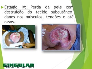  Estágio IV: Perda da pele com
destruição do tecido subcutâneo,
danos nos músculos, tendões e até
ossos.
 