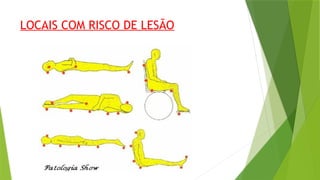 LOCAIS COM RISCO DE LESÃO
 