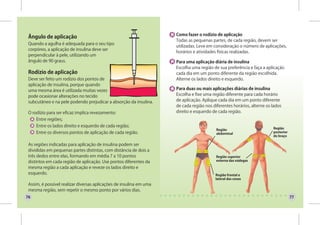 Como fazer o rodízio de aplicação
 Ângulo de aplicação
                                                                     Todas as pequenas partes, de cada região, devem ser
 Quando a agulha é adequada para o seu tipo
                                                                     utilizadas. Leve em consideração o número de aplicações,
 corpóreo, a aplicação de insulina deve ser
                                                                     horários e atividades físicas realizadas.
 perpendicular à pele, utilizando um
 ângulo de 90 graus.                                                 Para uma aplicação diária de insulina
                                                                     Escolha uma região de sua preferência e faça a aplicação
 Rodízio de aplicação                                                cada dia em um ponto diferente da região escolhida.
 Deve ser feito um rodízio dos pontos de                             Alterne os lados direito e esquerdo.
 aplicação de insulina, porque quando
 uma mesma área é utilizada muitas vezes                             Para duas ou mais aplicações diárias de insulina
 pode ocasionar alterações no tecido                                 Escolha e fixe uma região diferente para cada horário
 subcutâneo e na pele podendo prejudicar a absorção da insulina.     de aplicação. Aplique cada dia em um ponto diferente
                                                                     de cada região nos diferentes horários, alterne os lados
 O rodízio para ser eficaz implica revezamento:                      direito e esquerdo de cada região.
     Entre regiões;
     Entre os lados direito e esquerdo de cada região;                                                                  Região
                                                                                          Região
     Entre os diversos pontos de aplicação de cada região.                                abdominal                     posterior
                                                                                                                        do braço

 As regiões indicadas para aplicação de insulina podem ser
 divididas em pequenas partes distintas, com distância de dois a
 três dedos entre elas, formando em média 7 a 10 pontos                                   Região superior
 distintos em cada região de aplicação. Use pontos diferentes da                          externa das nádegas

 mesma região a cada aplicação e reveze os lados direito e
 esquerdo.                                                                               Região frontal e
                                                                                         lateral das coxas
 Assim, é possível realizar diversas aplicações de insulina em uma
 mesma região, sem repetir o mesmo ponto por vários dias.
76                                                                                                                                  77
 