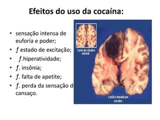 Efeitos do uso da cocaína:
• sensação intensa de
euforia e poder;
• ƒ estado de excitação;
• ƒ.hiperatividade;
• ƒ. insônia;
• ƒ. falta de apetite;
• ƒ. perda da sensação de
cansaço.
 