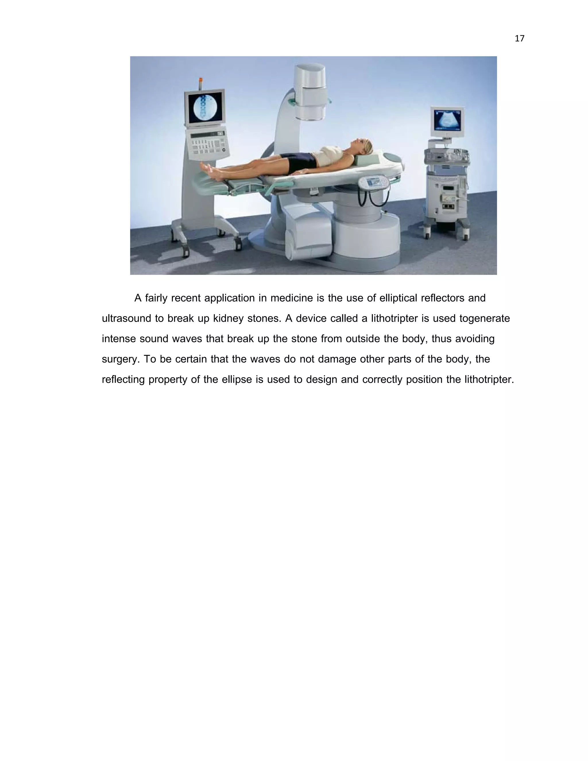 16 
 
This figure shows a pair of elliptical gears with pivot points at foci. Such gears
transfer constant rotational speed to variable rotational speed, and vice versa.
This figure shows an elliptical dome. An interesting property of such a dome is
that a sound or light source at one focus will reflect off the dome and pass through
other focus. One of the chambers in the Capitol Building in Washington, D.C., has such
a dome, and is referred to as a whispering room because a whisperer one focus can be
easily heard at the other focus.
 