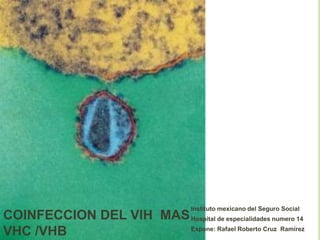 COINFECCION DEL VIH MAS
VHC /VHB
Instituto mexicano del Seguro Social
Hospital de especialidades numero 14
Expone: Rafael Roberto Cruz Ramírez
 