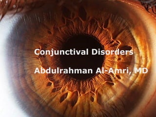 Conjunctival Disorders
Abdulrahman Al-Amri, MD
 