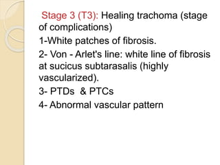 conjuctival inflammation and degenration | PPTX