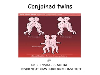 Conjoined twins

BY
Dr. CHINMAY . P . MEHTA
RESIDENT AT KIMS HUBLI &NMR INSTITUTE .

 