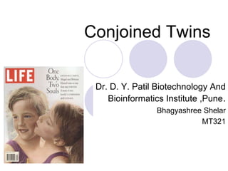Conjoined Twins
Dr. D. Y. Patil Biotechnology And
Bioinformatics Institute ,Pune.
Bhagyashree Shelar
MT321
 