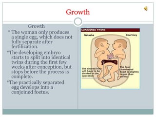Overall survival rate of conjoined twins is some where between 5 and 25 percent .Formed                 Formed * Conjoined twins are genetically identical.They are always the same sex.