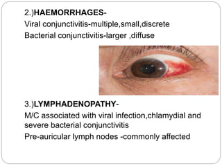 CHLAMYDIAL
CONJUNCTIVITIS
 Like viruses they are obligate intracellular and
filterable
 Like bacteria they contain both ...