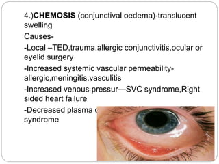 TRACHOMA
 The word 'trachoma' (Greek word)stands for
'rough' which describes the surface appearance
of the conjunctiva in...